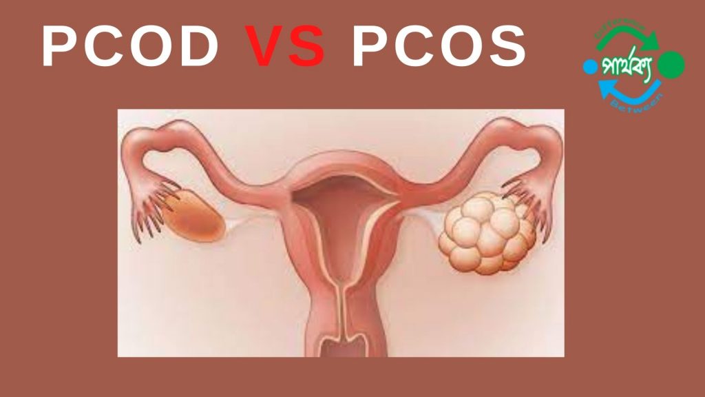 PCOD ও PCOS