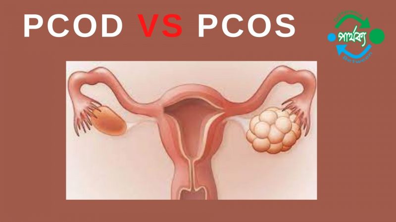 PCOD ও PCOS